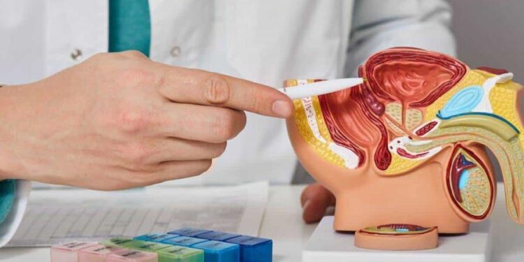Día Mundial del Cáncer de Próstata: una fecha para concientizar y sensibilizar a la sociedad