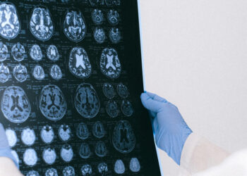Diez claves para llegar a la vejez con un cerebro sano