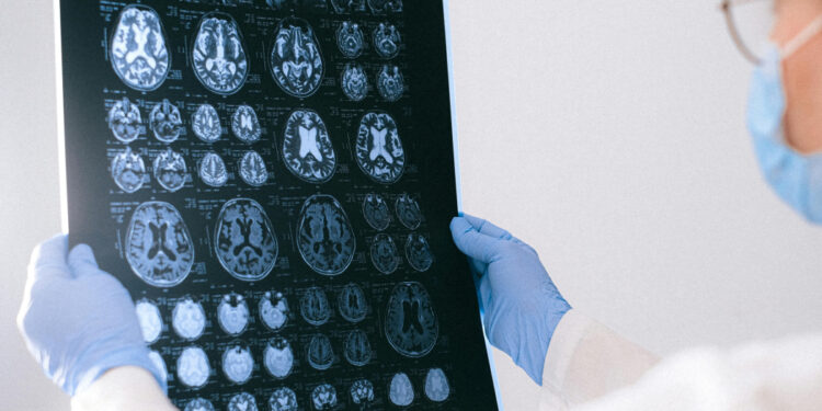 Diez claves para llegar a la vejez con un cerebro sano