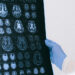 Diez claves para llegar a la vejez con un cerebro sano