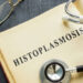 HISTOPLASMOSIS